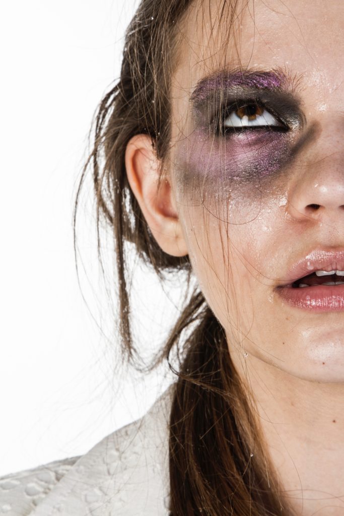 25 novembre giornata mondiale contro la violenza sulla donna rappresentata dalla metà dfi un viso di donna con l'occhio tumefatto da un pugno e lo sguardo rivolto in alto e la bocca aperta