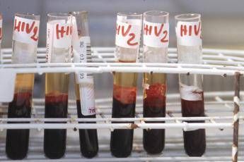 Aids, l’accusa di Bassetti: “Torna a far paura per colpa di Trump”