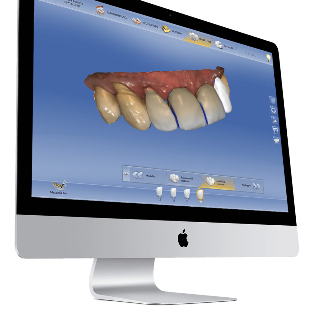 tecnologia digitale un computer con impostazione per studio di un pazienti denti e gengive in primo piano
