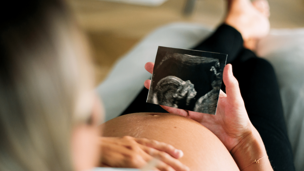 donna in grqdidanza sdraiata che osserva lecografia in cui il bambibo è completamente formato