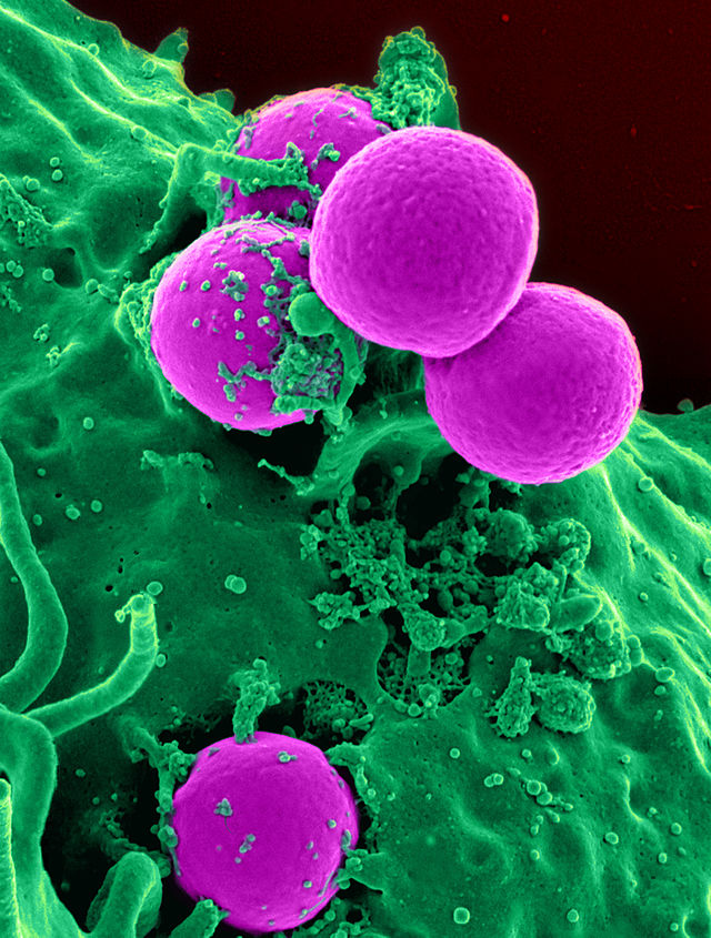 immagine al microscopio di un batterio viola e verde