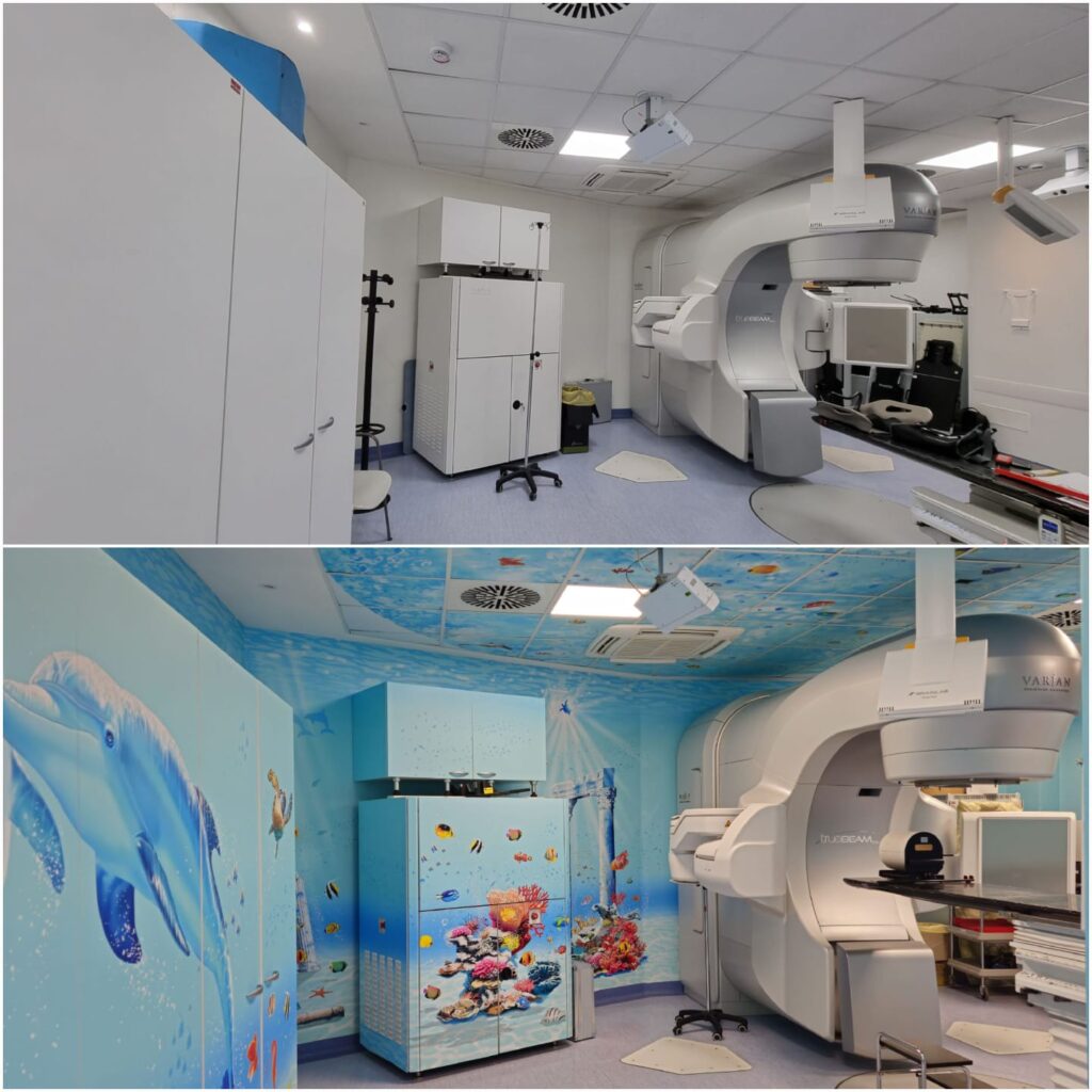 Radioterapia per bambini - il prima e dopo. Nella prima foto in alto la stanza con i macchinari di radioterapia,le pareti bianche . nella foto sotto la stessa stanza ma le pareti sono azzurre con coralli e delfini, anche il soffitto è dipinto come il mare e coralli