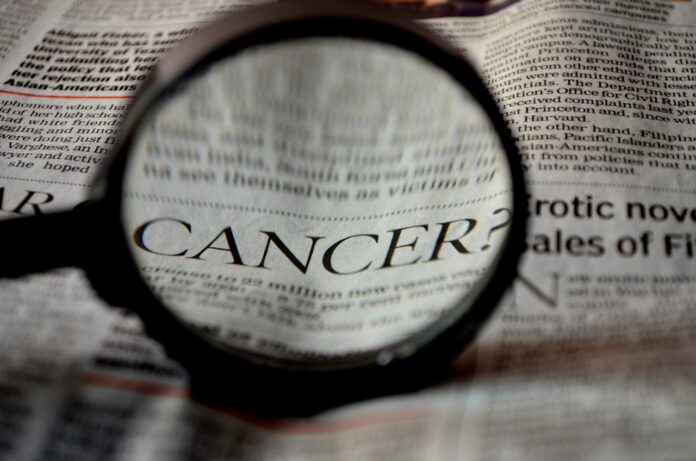 tumori - nella foto un foglio di giornale con la parola CANCER scritta in grande e una lente che la ingrandisce ulteriormente